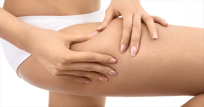 Cellulite Treatment - Derma Technique Houston Day Spa